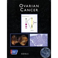 子宫癌Ovarian Cancer