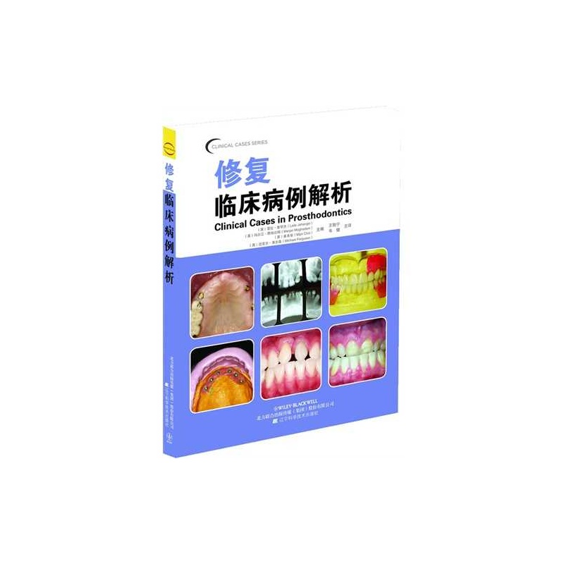 【修复临床病例解析(口腔临床病例解析丛书)图