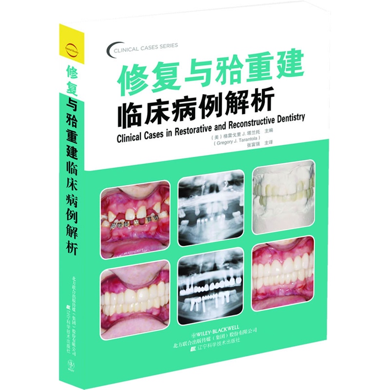 《修复与牙合重建临床病例解析(口腔临床病例