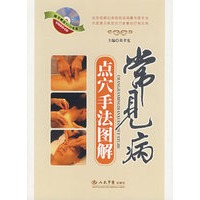 常见病点穴手法图解（附光盘）