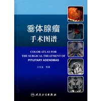 垂体腺瘤手术图谱