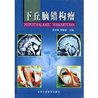 下丘脑错构瘤（精装）