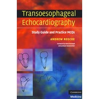 Transoesophageal Echocardiography经食管超声心动图检查术