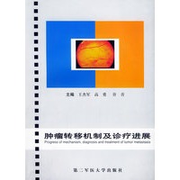 肿瘤转移机制及诊疗进展