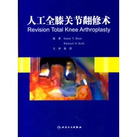 人工全膝关节翻修术