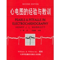 心电图的经验与教训
